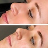 Image 1: Perfect Brows with One Microblading Session with or without Touch-Up 