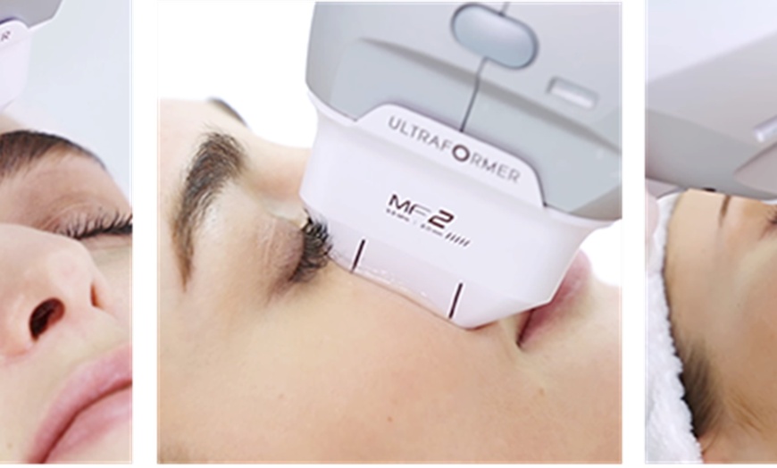 Image 9: Up to 67% Off on Facelift - Non-Surgical at Zen Beauty Ltd