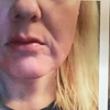 Image 1: 1, 2, or 3 Sessions RF Skin Tightening, Microdermabrasion &  Peel 