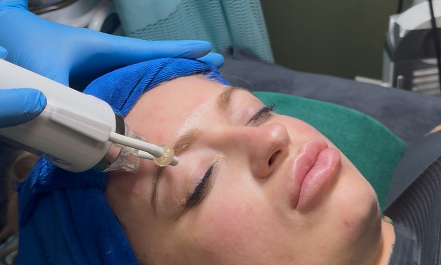 Image 3: Up to 35% Off on Facial at Hang's Spa
