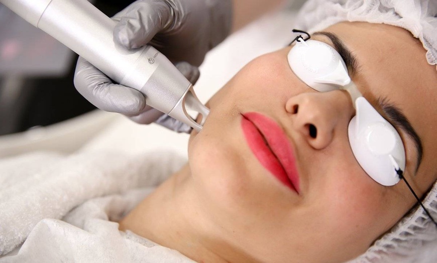 Image 10: Karty podarunkowe do wydania na usługi w salonie Estetic World