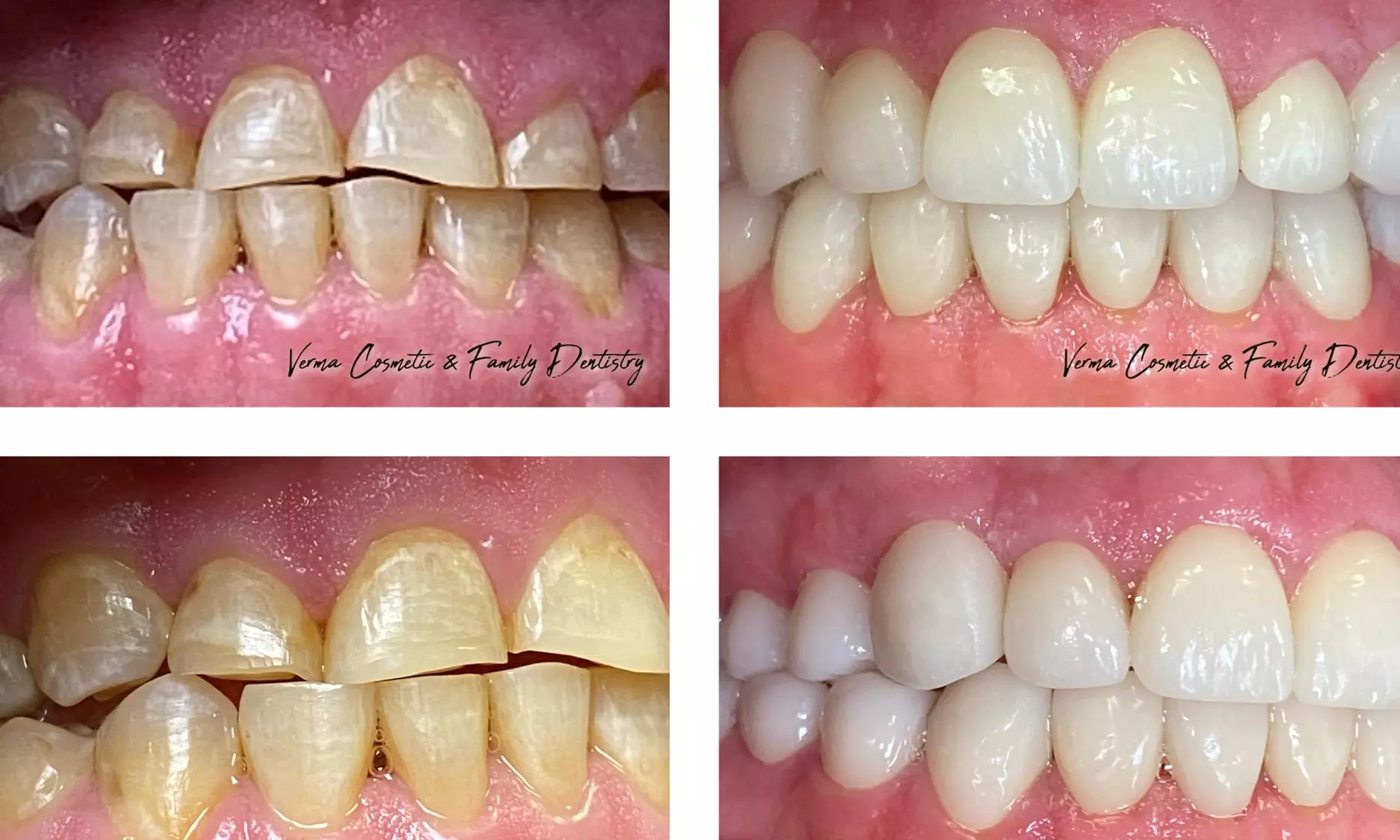 Get Comprehensive Dental Exam, Cleaning and Set of X-Rays