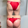 Image 2: Boost Your Confidence with 30, 60, or 90-Minute Non-Invasive Butt Lift