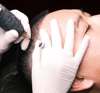 Scalp Male Hair Loss One  Session - A V Lash n Brow