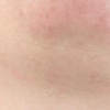 Image 2: 30-, 45- or 60-Minute Electrolysis Hair Removal Session + Consultation