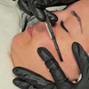 Image 3: Luxury Microneedling Facial or Microneedling Facial & Dermaplaning