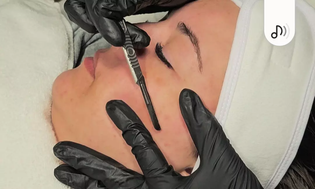 Luxury Microneedling Facial or Microneedling Facial & Dermaplaning