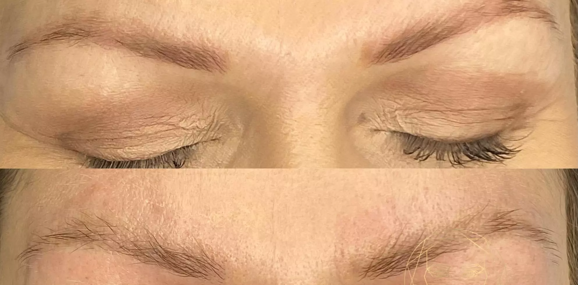 Laserowe oraz bezlaserowe usuwanie makijażu permanentnego brwi i ust