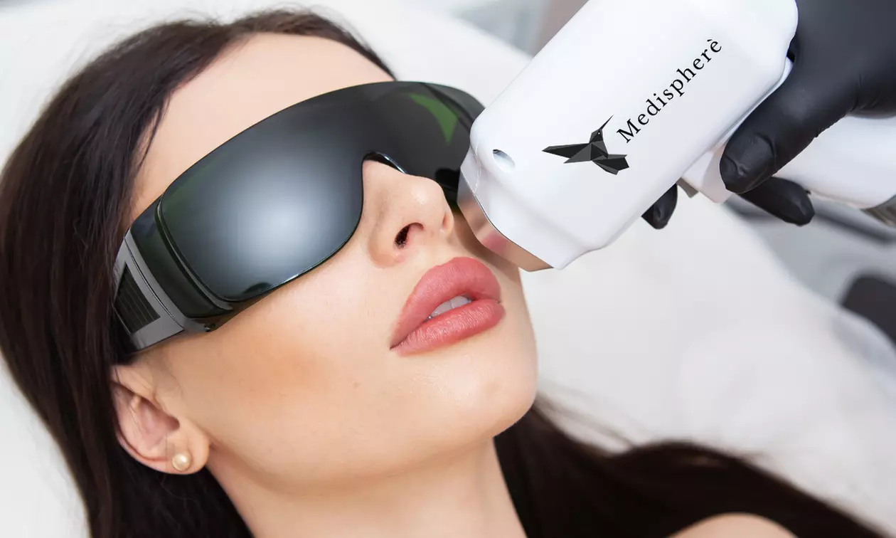 Laat een zone naar keuze 1 jaar lang onbeperkt ontharen met een laser voor een gladde, stralende huid bij CLINIQUES - Image 6