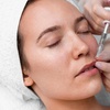 Image 8: Up to 53% Off on Injection - Dermal Filler at UK Aesthetics Lounge
