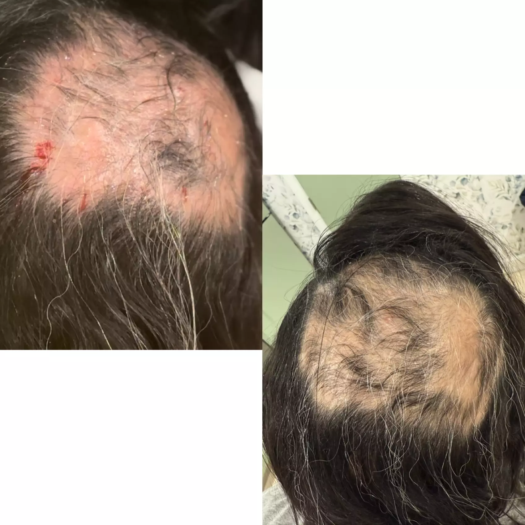 Up to 63% Off on Injection - Plasma at Soleil med spa