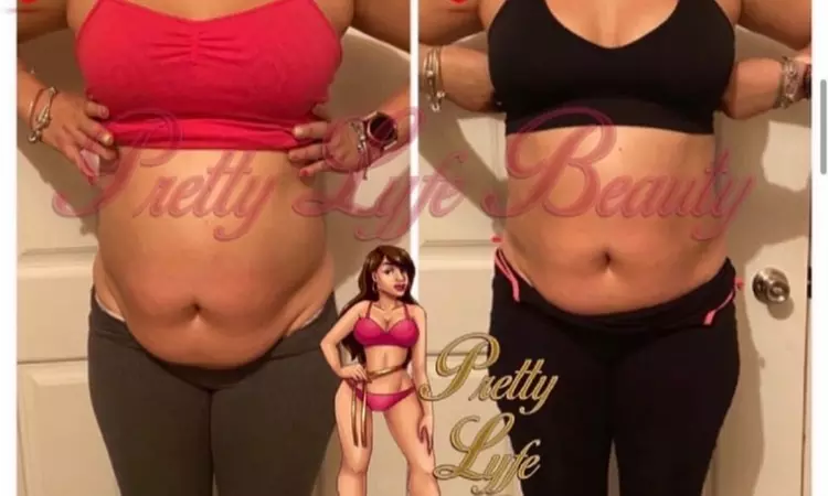 Weight Reduction Program / Center at Pretty Lyfe Esthetics