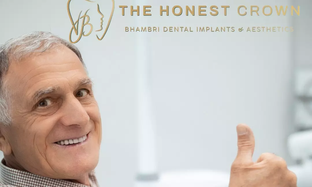 Transform Your Smile: One, Two or Three Dental Implants with Abutments and Crowns - Up to 30% Off