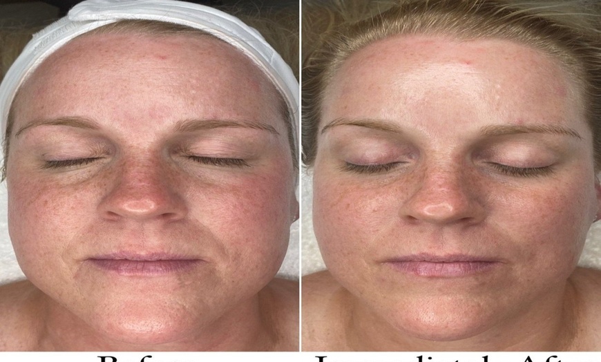 Image 5: Achieve Radiance with 6, 10, or 20 Dermalux MD Triwave LED Therapy 
