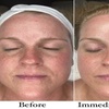 Image 5: Achieve Radiance with 6, 10, or 20 Dermalux MD Triwave LED Therapy 