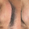 Image 2: Smooth Skin with One or Three Brazilian, or Eyebrow Waxing Sessions