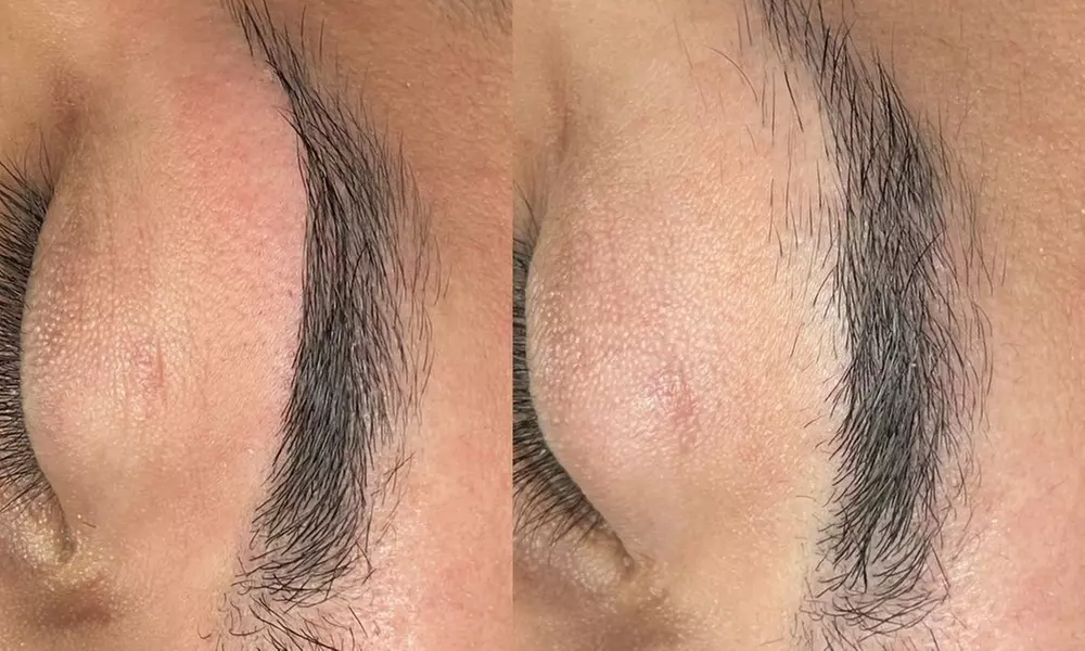 Smooth Skin with One or Three Brazilian, or Eyebrow Waxing Sessions