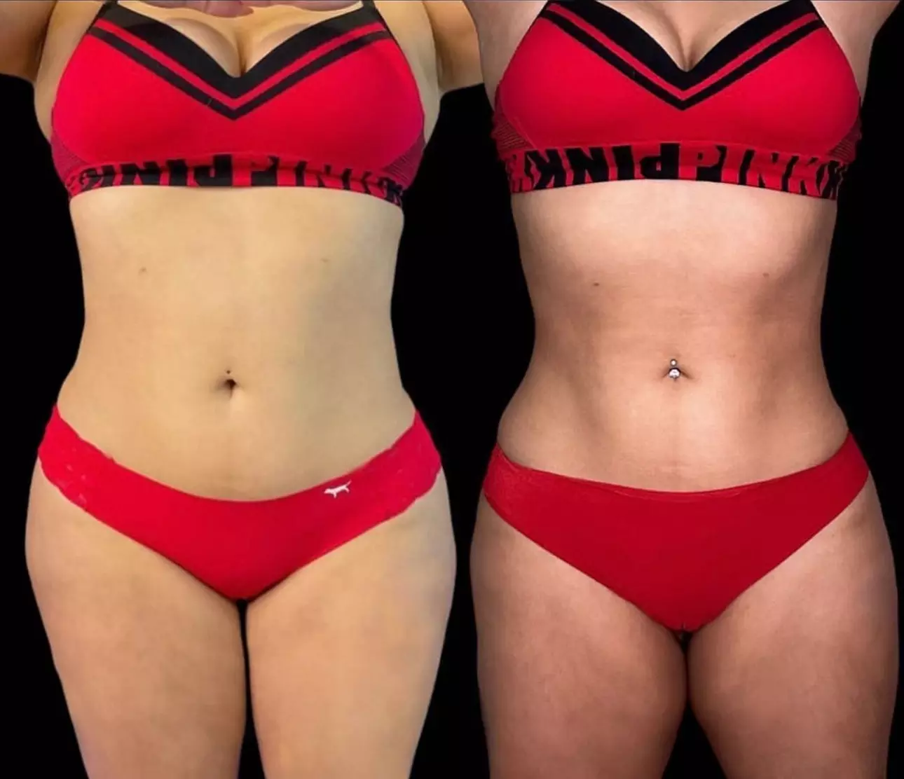 Discover EMS BOSS: 3 High intensity-focused electromagnetic Sessions for 40% Fat Loss & 50% Muscle Gain w/ up to 50% Off - Primary Image
