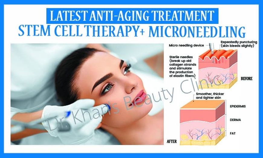 Image 1: Revitalize Your Skin: Stem Cell Therapy + Microneedling 