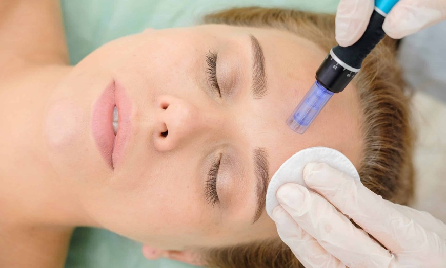 Image 7: One, Two, or Three Sessions: Hydrafacial with LED Therapy