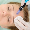 Image 7: One, Two, or Three Sessions: Hydrafacial with LED Therapy
