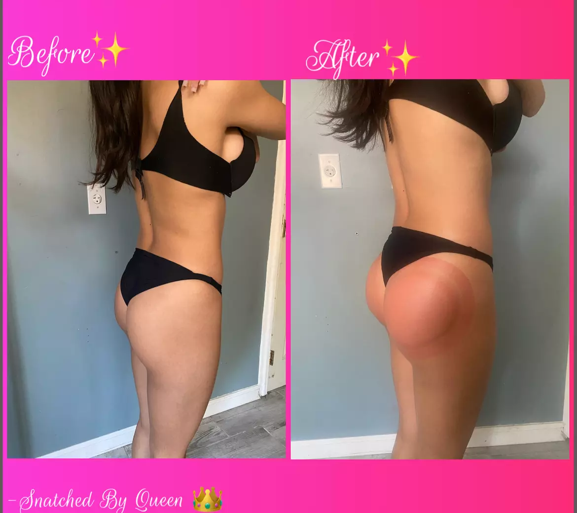 Up to 60% Off on Non-Surgical Butt Lift at Snatched By Queen - Primary Image