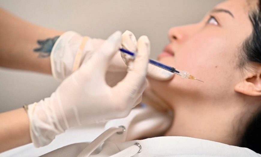 Image 4: 20, 40, or 60 Units of Botox for Fine Lines & Full-Face Refresh