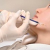 Image 4: 20, 40, or 60 Units of Botox for Fine Lines & Full-Face Refresh