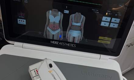 One Ultherapy lower face only (smile lines and below to double chin only) - Enhanced by NLO