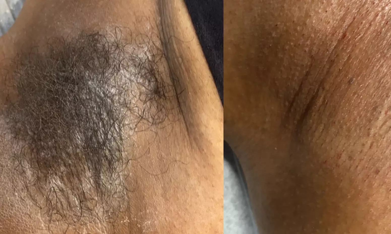 Up to 47% Off on Waxing - Underarm at Divine Gloww - Second Medium