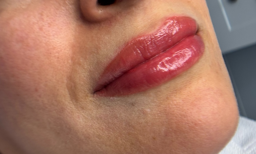 Image 2: Transform Your Look with a Lip Blushing/Neutralization Session