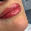 Image 2: Transform Your Look with a Lip Blushing/Neutralization Session