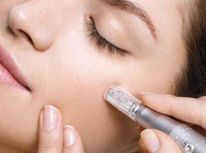 Microneedling Gesicht  - Beauty Atelier Charme