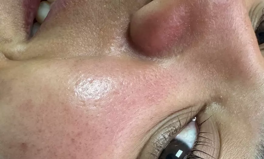 Image 1: Limpieza facial de 60 minutps con peeling enzimático o rutina completa