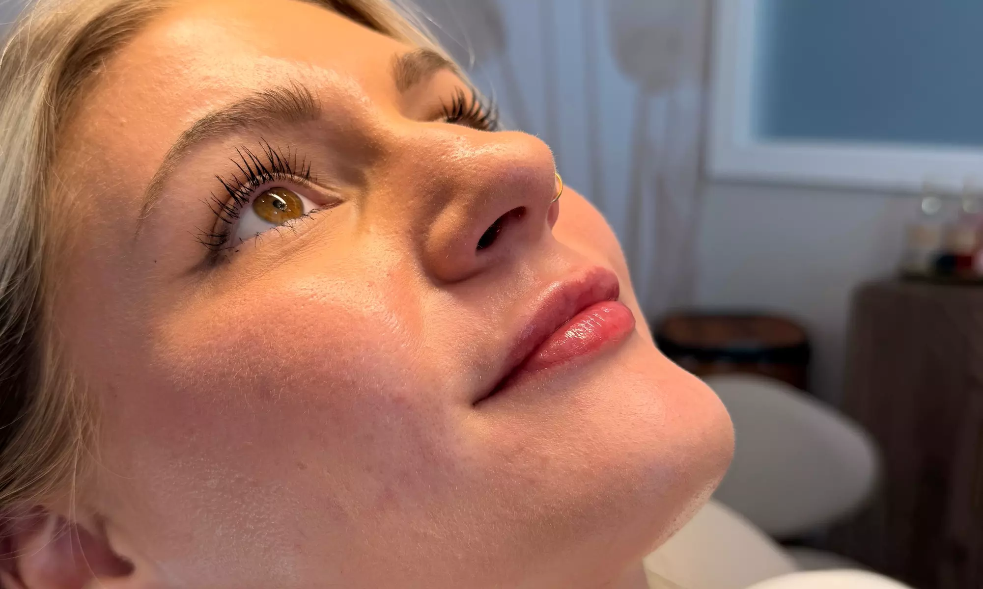 20, 40 or 60 Units of Botox or 1 ML Syringe Versa