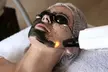 Laserowy peeling węglowy na twarz i szyję w Studio Wizażu i Stylizacji w Rzeszowie - Second Medium