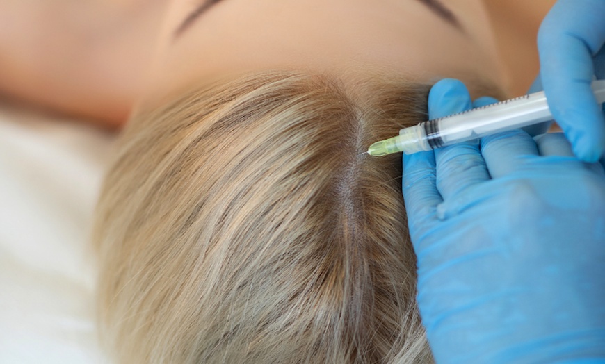 Image 3: 30 Min. PRP-Behandlung für Kopfhaut zur Anregung des Haarwachstums
