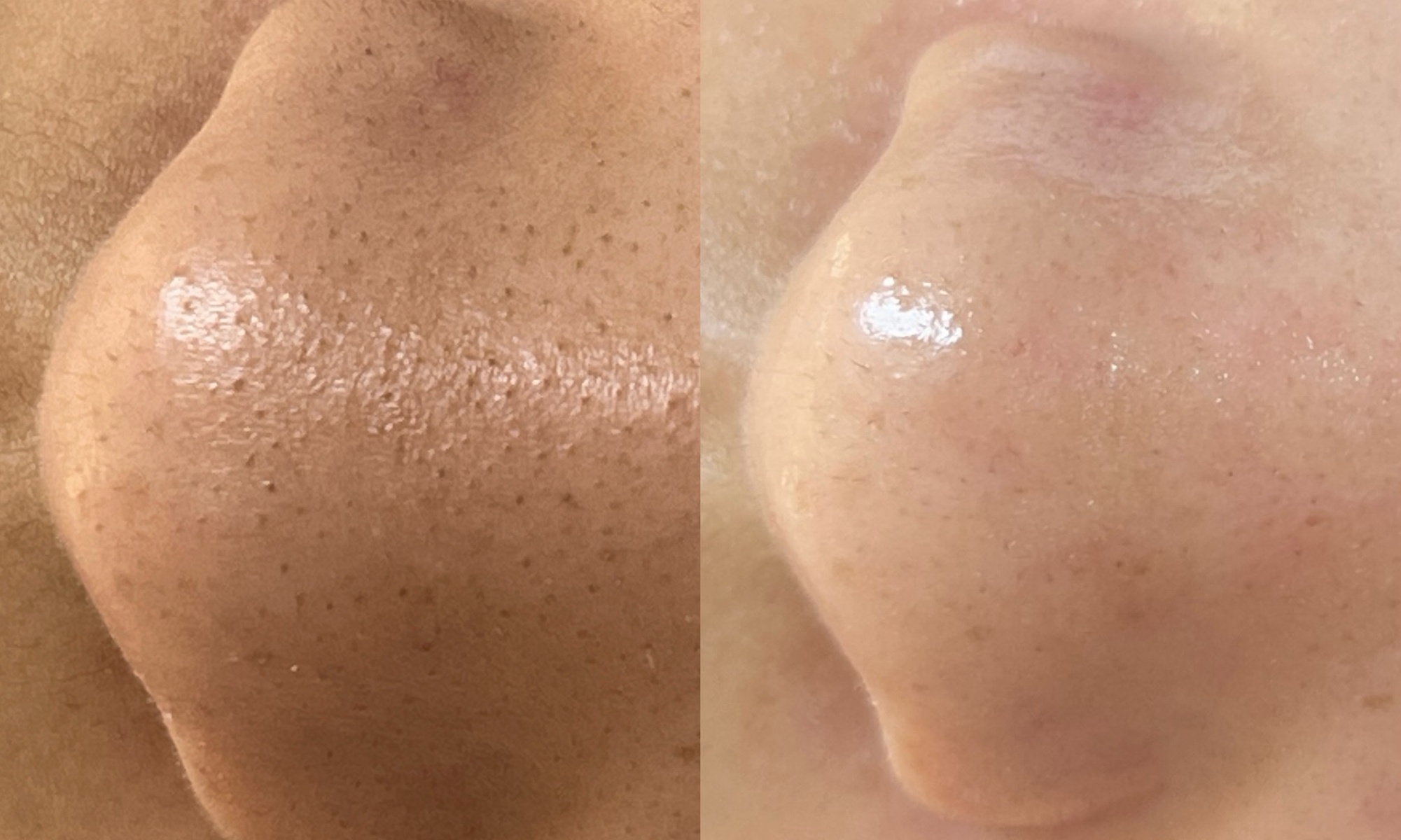Rejuvenate Your Skin with a 40-Minute Deep Cleansing Facial