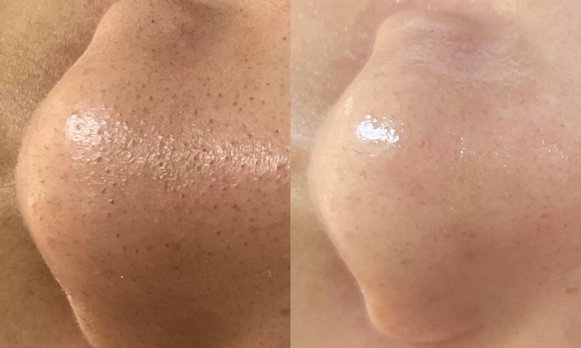 Transform with OBeauty Facial's 40-Minute Deep Cleansing, enjoy up to 50% off for radiant skin texture and clarity - Primary Image