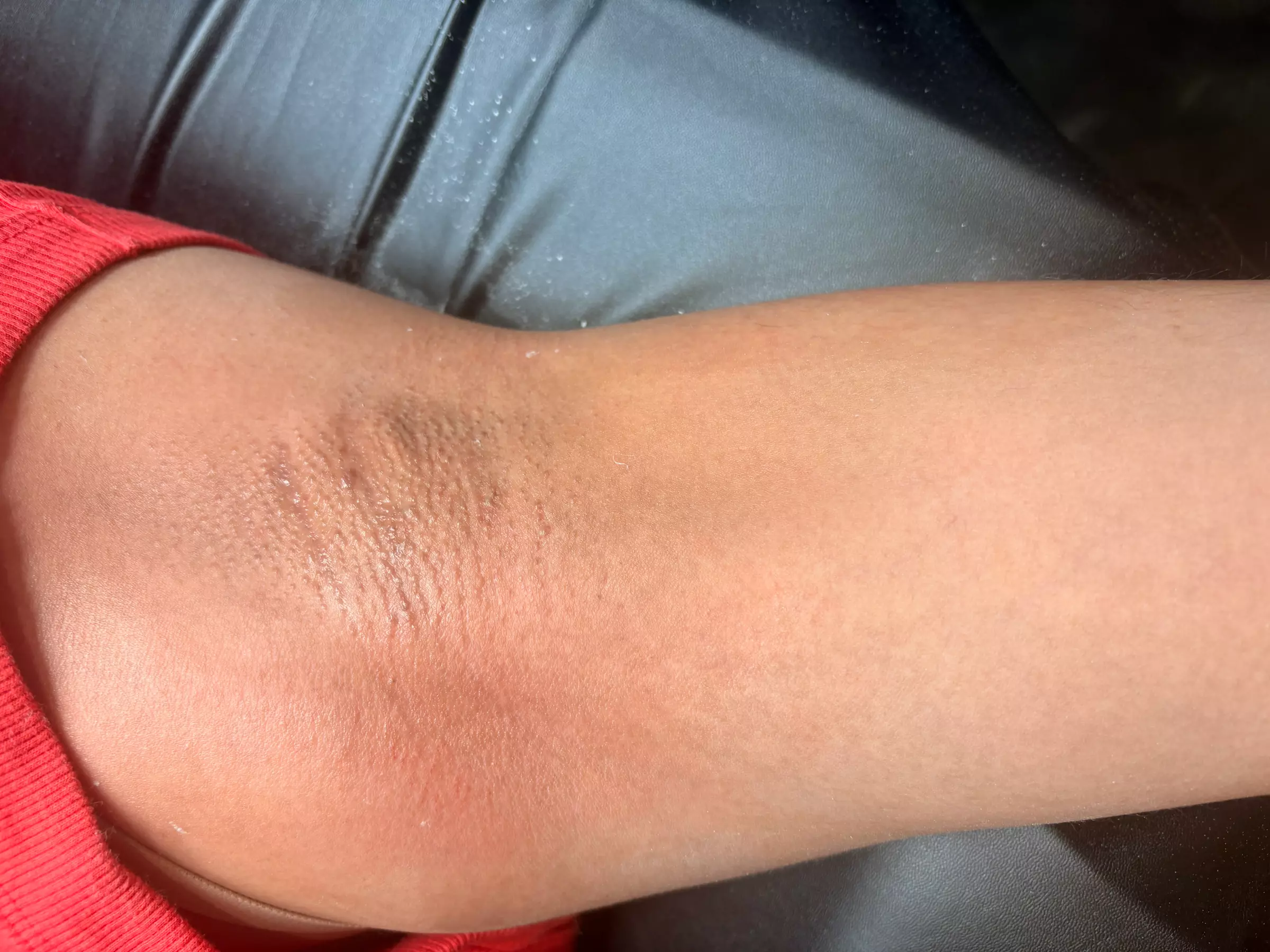 Get Smooth Skin with One, Three, or Five Brazilian Waxing Sessions