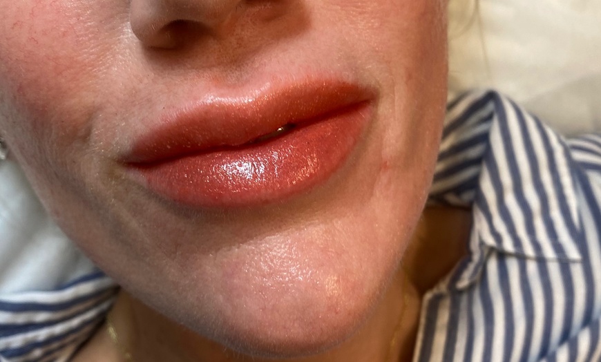 Image 8: Enhance Your Look With Microblading, Lip Blush or Eyeliner Tattoo 