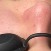 Image 4: Luxury Exosome Mesotherapy with PDRN for Skin Repair & Radiance