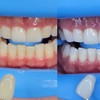 Image 1: Up to 46% Off on Teeth Whitening at Vs Aesthetics