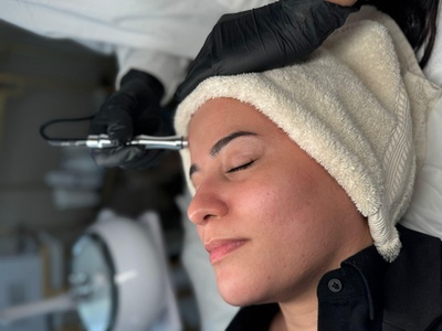 One Microdermabrasion Facial - Tiam Spa Laser And Skin Center