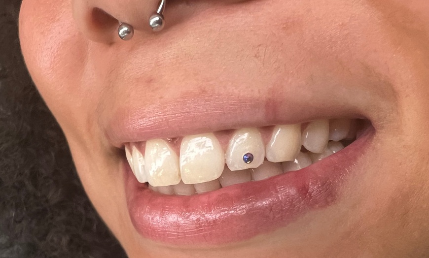 Image 5: Sparkle up with One or Two Tooth Gems for a Bright Smile
