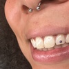 Image 5: Sparkle up with One or Two Tooth Gems for a Bright Smile