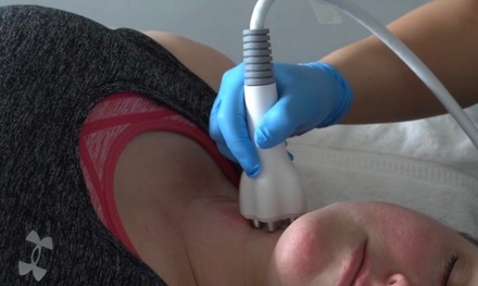One RF Skin Tightening Full-face Treatment - The Doctor’s House of Natural Beauty