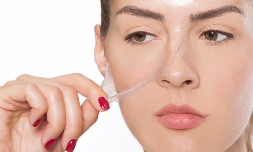 Image 1: Revitalize Your Skin with a Chemical Peel Session