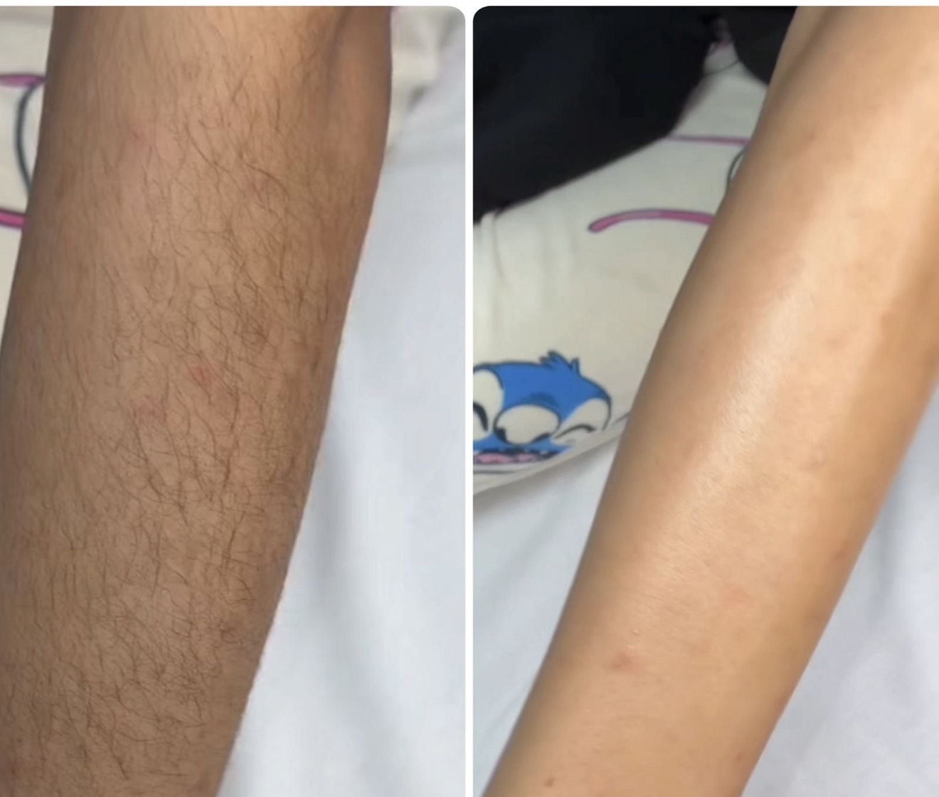 Flawless Skin with Full Body, Face or Brazilian Waxing