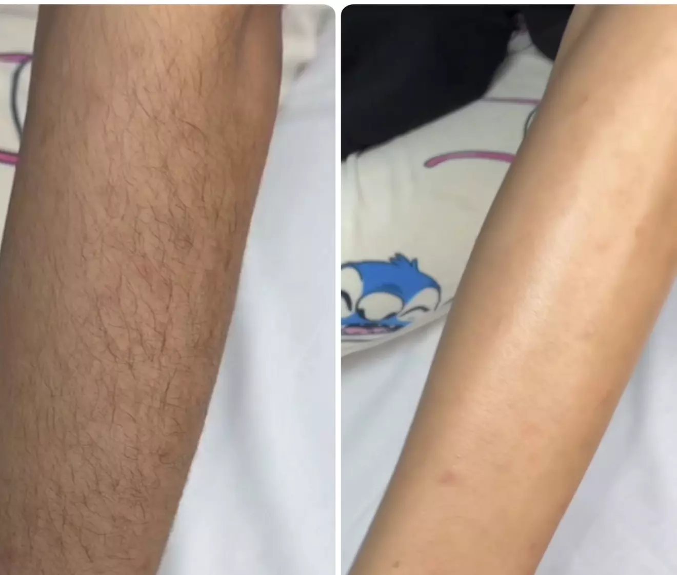 Smooth Skin with Full Body, Face or Brazilian Waxing at Iconic Beauty Spa (Up to 60%Off) - Primary Image